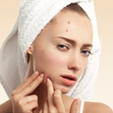 Acne-Prone Skin